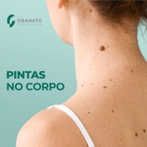 Como saber se uma pinta indica câncer?