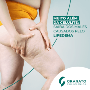 Você já ouvir falar em lipedema?