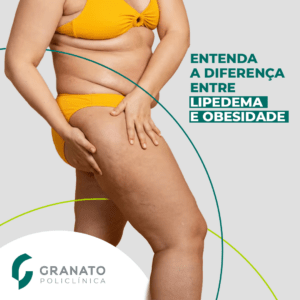 Lipedema x Obesidade: Entenda a diferença entre as duas doenças