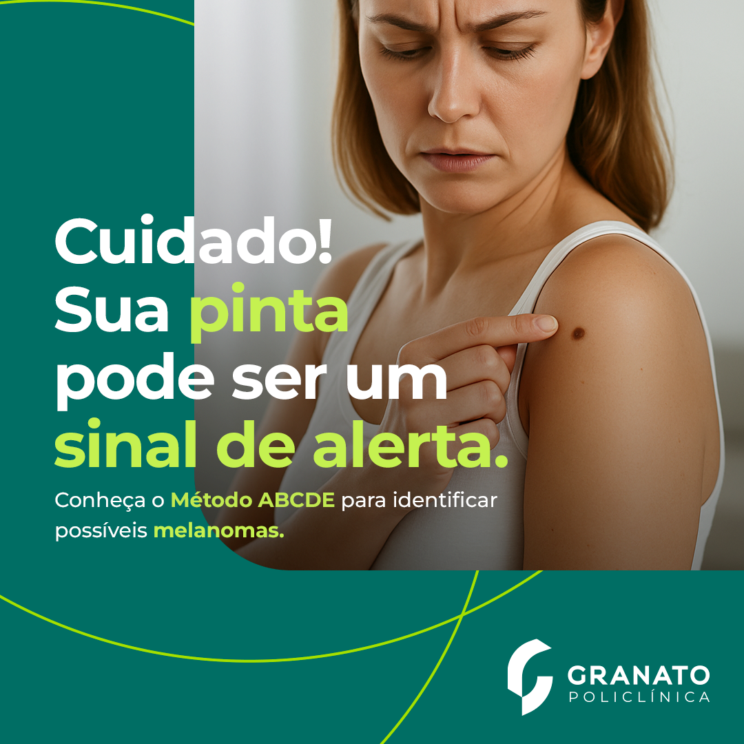 Sua pinta pode ser um sinal de alerta! Conheça o método ABCDE para identificar possíveis melanomas