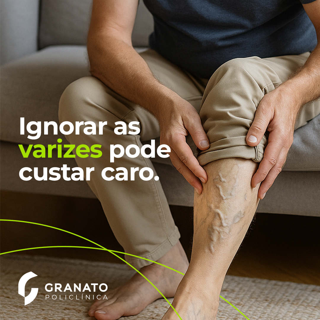 Veja o que acontece quando as varizes não são tratadas